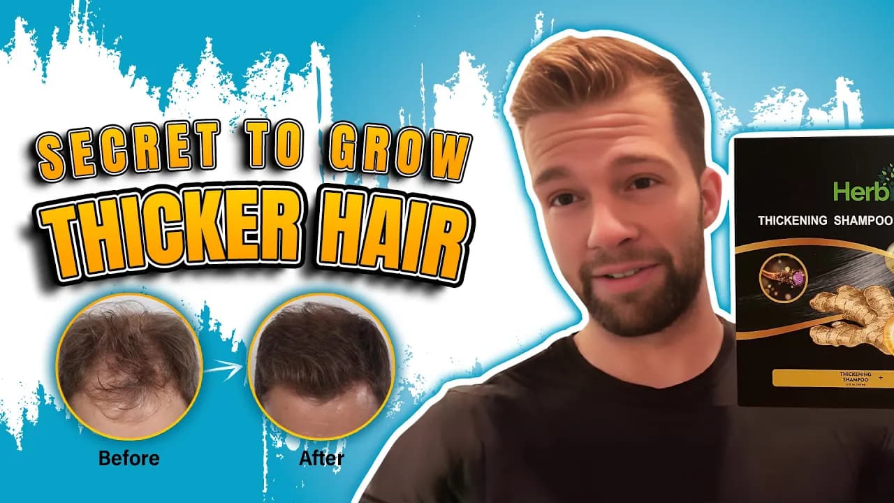 I Grew THICKER Hair in 30 Days with This Regrowth Treatment!